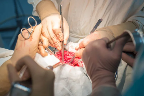 a surgeon with assistants, in a sterile operating room, is operated on internal organs.