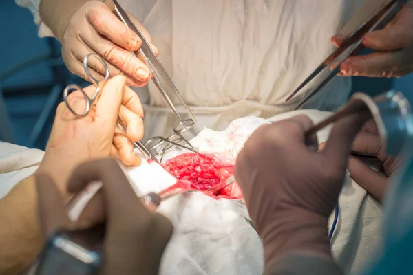Un cirujano con asistentes, en un quirófano estéril, es operado en órganos internos . — Foto de Stock