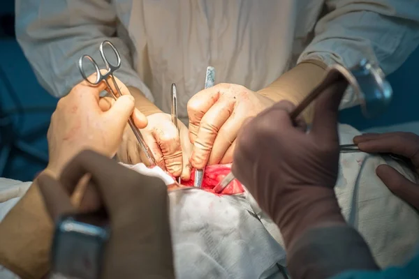 Um cirurgião com assistentes, em uma sala de cirurgia estéril, é operado em órgãos internos . — Fotografia de Stock