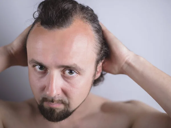Retrato de um jovem com um cabelo magnífico que cai cedo na testa. O problema do envelhecimento prematuro. Pentear o cabelo e olhar indignamente no espelho — Fotografia de Stock
