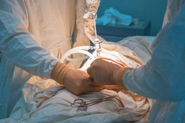 滅菌手術室で腹腔鏡手術の終了.内側のリングの皮膚縫合 — ストック写真