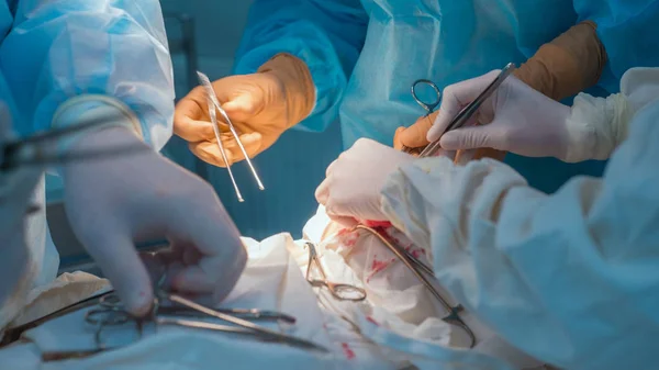 Close-up, uma equipe de cirurgiões pediátricos realiza cirurgia para linfadenite de orelha. Oncologistas realizam uma punção para diagnóstico — Fotografia de Stock