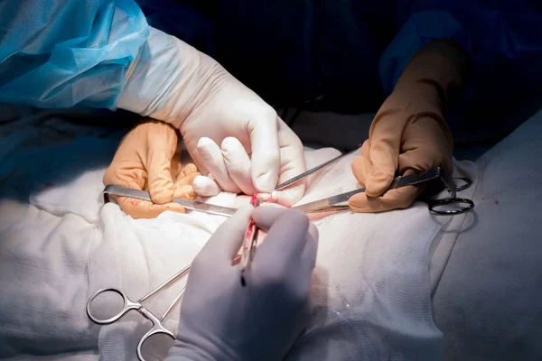 Cerrahi dikiş. Steril bir ameliyathanede cerrah ve asistanın elleri hastanın çocuğunun cildine kozmetik dikiş atıyor.. — Stok fotoğraf