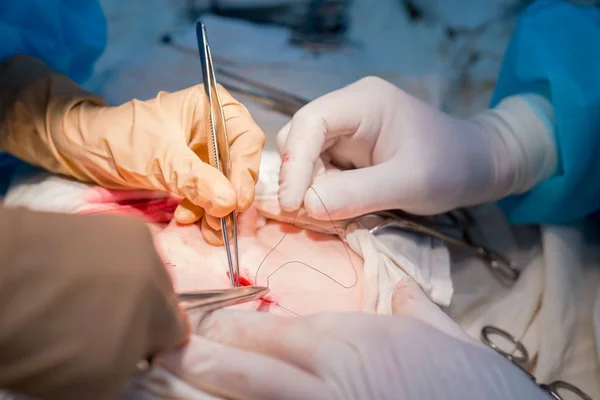 Chirurgiczny szew. Dłonie chirurga i asystenta w sterylnej sali operacyjnej nakładają kosmetyczne szwy na skórę dziecka pacjenta.. — Zdjęcie stockowe
