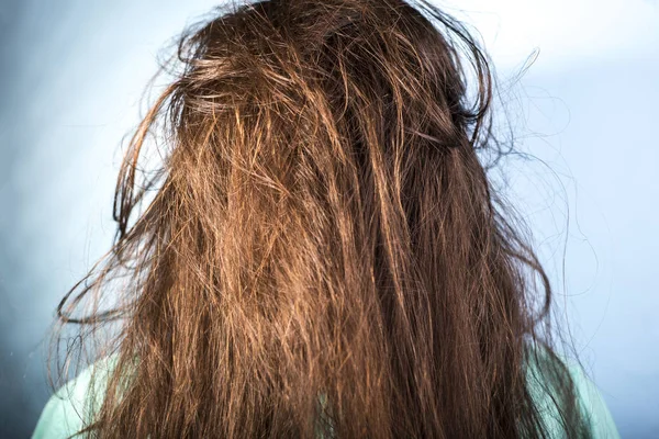 Portrait of a girl with dirty, greasy, disheveled hair and problematic scalp. On a blue background — Stock Photo, Image