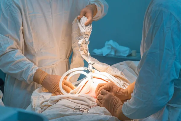 close-up hands of pediatric surgeons perform surgery using laparoscopic ports for endoscopic surgery. In a sterile operating room. Pediatric surgery, treatment of inguinal hernia in children by PIRS, suturing of the internal inguinal ring. Dropsy of 