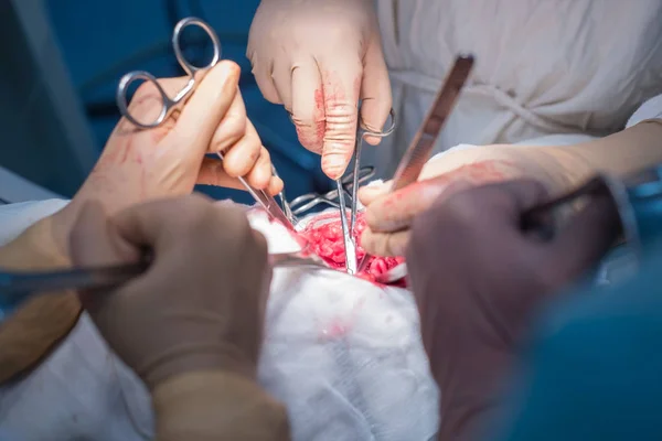 Zespół Chirurgów Wykonujący Operację Sterylna Sala Operacyjna Operacja Nerek Małego — Zdjęcie stockowe