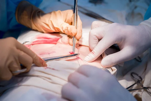 surgical suture. The hands of the surgeon and assistant in a sterile operating room impose a cosmetic suture on the skin of the patient\'s child. The end of the urological operation
