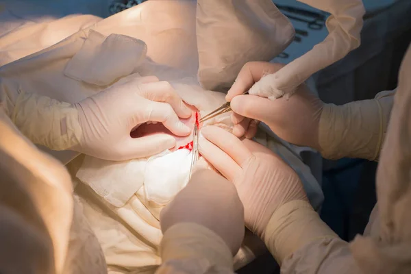 Visão Superior Estágios Cirurgia Neurocirúrgica Para Instalação Uma Placa Titânio — Fotografia de Stock