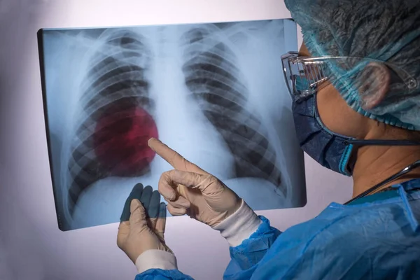 Portrait of a womans doctor, in a protective medical surgical suit, holding an X ray of the lungs with pathology in her hands, pointing to the pathology with her finger, looking at the camera. Studio portrait on a white background. Medicine, treatmen