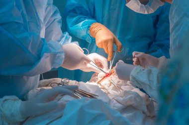 close-up, the hands of pediatric surgeons and an assistant operating a small patient with behind-the-ear lymphadenitis. In a sterile operating room. Removing a malignant tumor of the ear with a scalpel, suturing soft tissues, electrocoagulation, stop