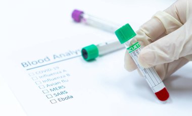 Bulaşıcı hastalığı test etmek için kan tübü, covid-19, influenza a and b, kuş gribi, Mers, Sars ve ebola beyaz arka planda.
