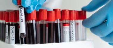 Kişisel koruyucu ekipman içindeki bilim adamlarının flaş resmi veya laboratuarda covid-19 veya coronavirus enfeksiyonunu tedavi edecek ilaçlar bulmak için araştırma ve deney yapan bilim adamları