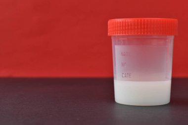 Kırmızı zemin üzerinde sperm bulunan ve yazı ve yazıtlar için yeri olan bir kap..