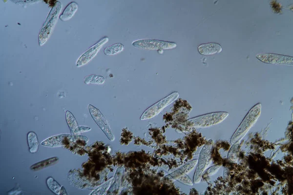 Plankton met microscopische ciliaten — Stockfoto