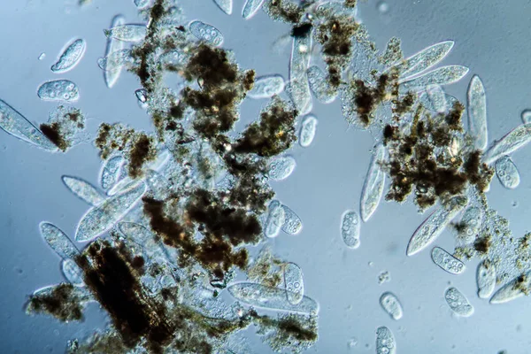 Plancton con ciliados microscópicos — Foto de Stock