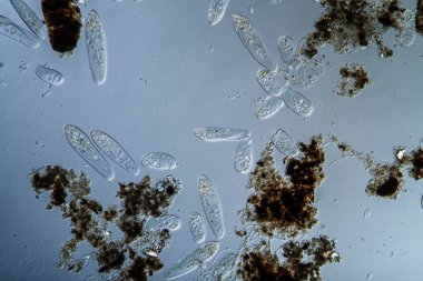 Mikroskobik silikatlı planktonlar