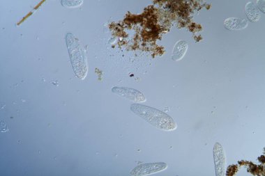 Mikroskobik silikatlı planktonlar