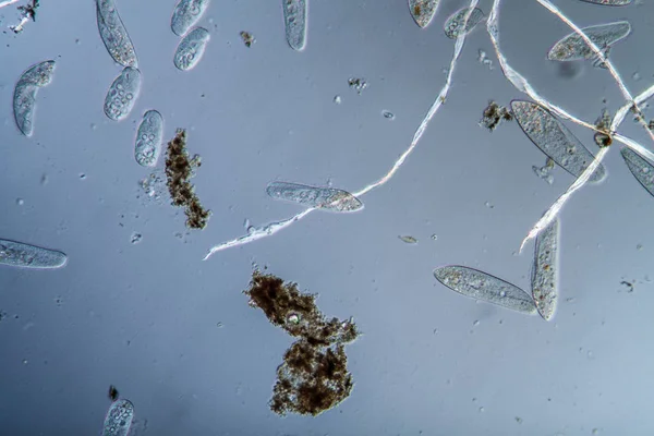 Plankton met microscopische ciliaten — Stockfoto