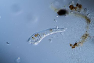 Su damlalarında mikroskobik plankton hayvanı olarak trompet hayvanları