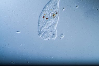 Su damlalarında mikroskobik plankton hayvanı olarak trompet hayvanları
