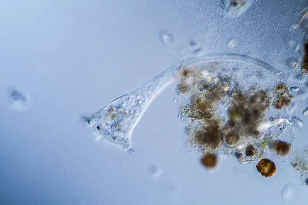 Trompetdier Als Microscopisch Planktondier Druppels Water — Stockfoto