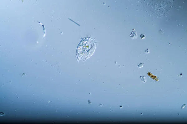 Цилиаты Одноклеточные Животные Планктона Каплях Воды — стоковое фото