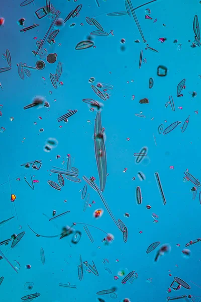 Tiny Microscopic Diatoms Drops Water — Stock Photo, Image