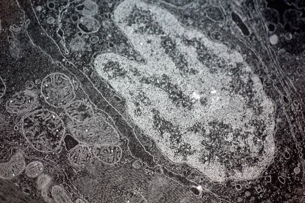 Elektronenmikroskopische Aufnahmen Tierischer Zellen Mit Zellkern Und Organellen — Stockfoto