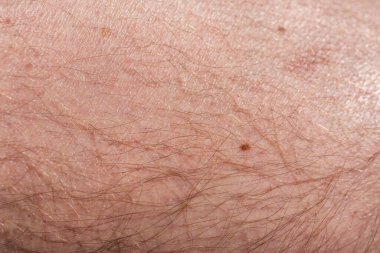 çok kıllı erkek teni.