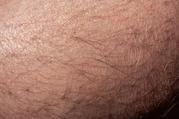 very hairy men\'s skin