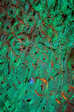 Enine bölümde kireçsiz kemik 100x