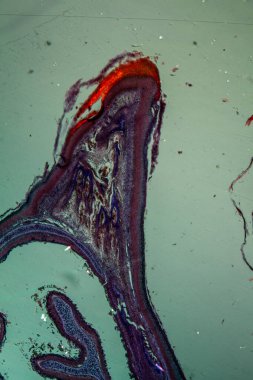 Genç bir kuşun gagasının ucu 50x büyümüş.