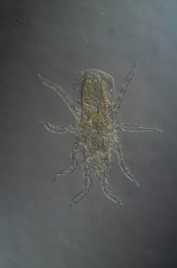 Endoasalak avcı mayt mikroskop altında 100 kat