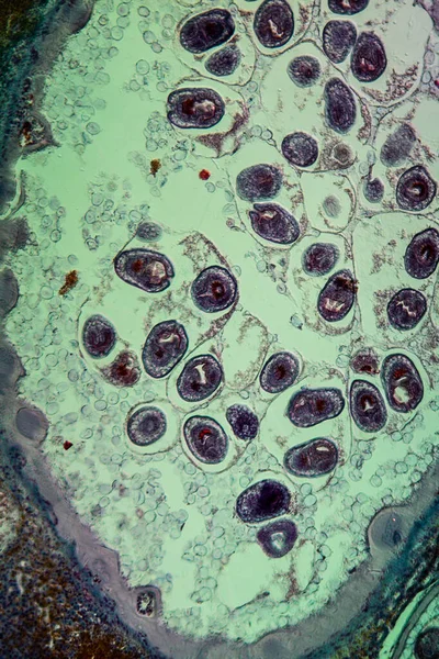 Parasit Echinococcus Pada Hati Yang Terinfeksi — Stok Foto