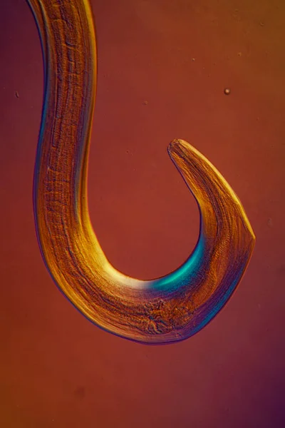 Oxiuris Parazit Sinekkurdu Mikroskopun Altında 100X — Stok fotoğraf
