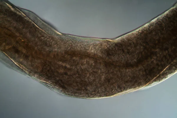 Oxiuris Parazitický Pinworm 100X Pod Mikroskopem — Stock fotografie