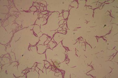 Bacillus antrakis şarbon mikroskop altında 200x