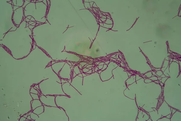 Bacillus Anthracis Anthrax Bajo Microscopio 200X — Foto de Stock