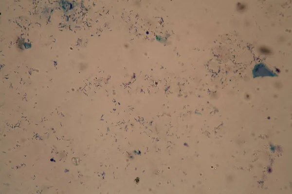 Tuberculosis bacteria under the microscope 400x