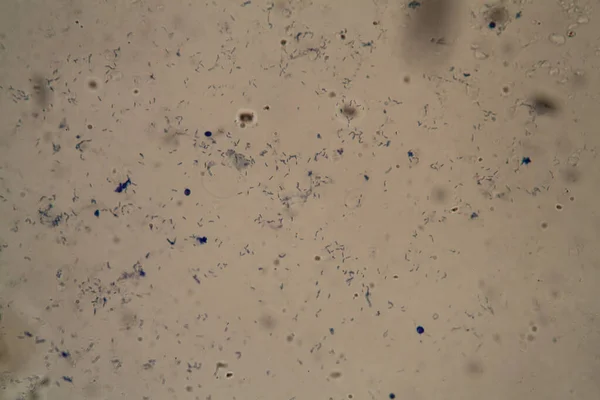 Туберкульозні Бактерії Під Мікроскопом 400X — стокове фото