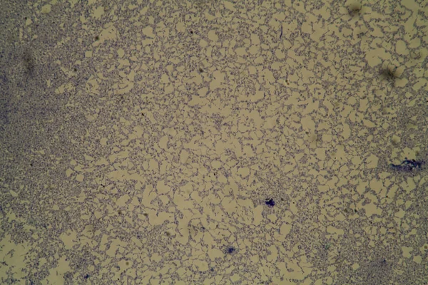 Patógeno Salmonela Bajo Microscopio 200X — Foto de Stock