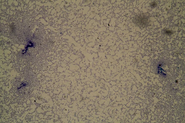 Salmonella Pathogeen Onder Microscoop 200X — Stockfoto