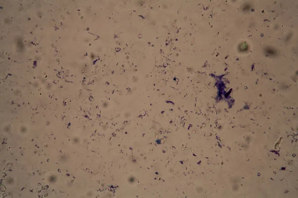 Bakteri Dari Ragi Bawah Mikroskop 400X — Stok Foto