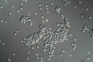 İdrar kesesi duvarındaki mukozal hücre epitelyumu 400x