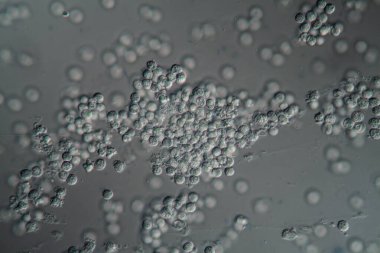 İdrar kesesi duvarındaki mukozal hücre epitelyumu 400x