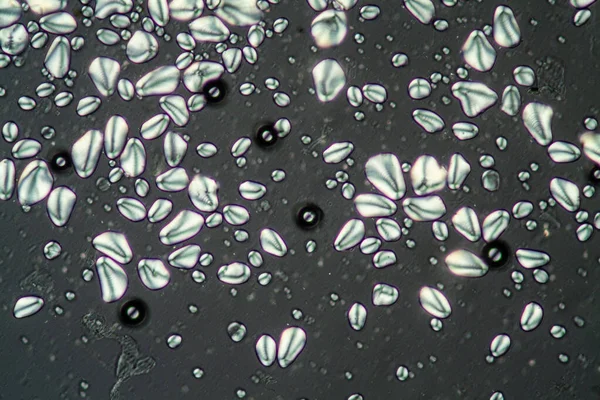 Σπόροι Αμύλου Γεωμήλων Κάτω Από Μικροσκόπιο 200X — Φωτογραφία Αρχείου