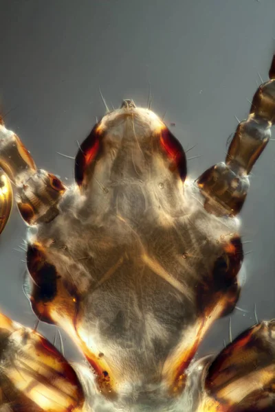 Head Head Louse Sucking Mouth Tools — Stock Photo, Image