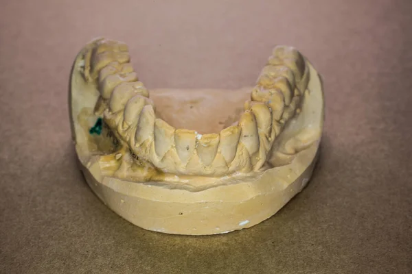 Upper jaw impression as a plaster model