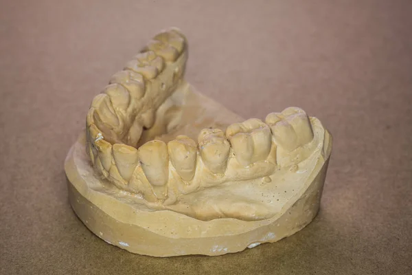 Upper jaw impression as a plaster model